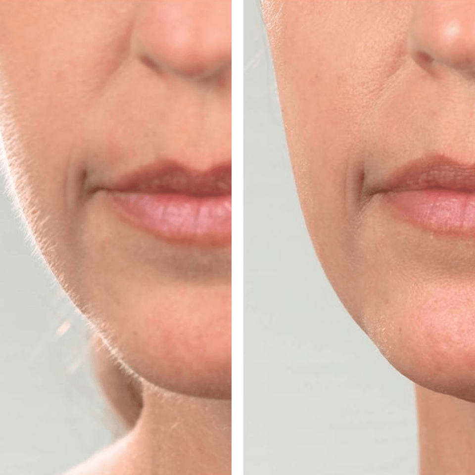 EpiBella image